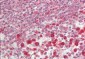 GPI Antibody